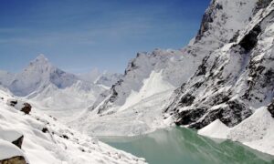 home exterior upgrade homemendous